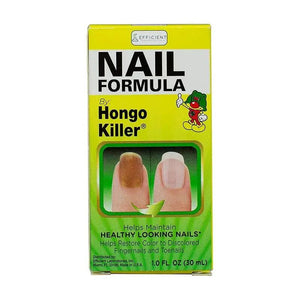 HONGO KILLER NAIL FORMULA 1FO by Hongo Killer